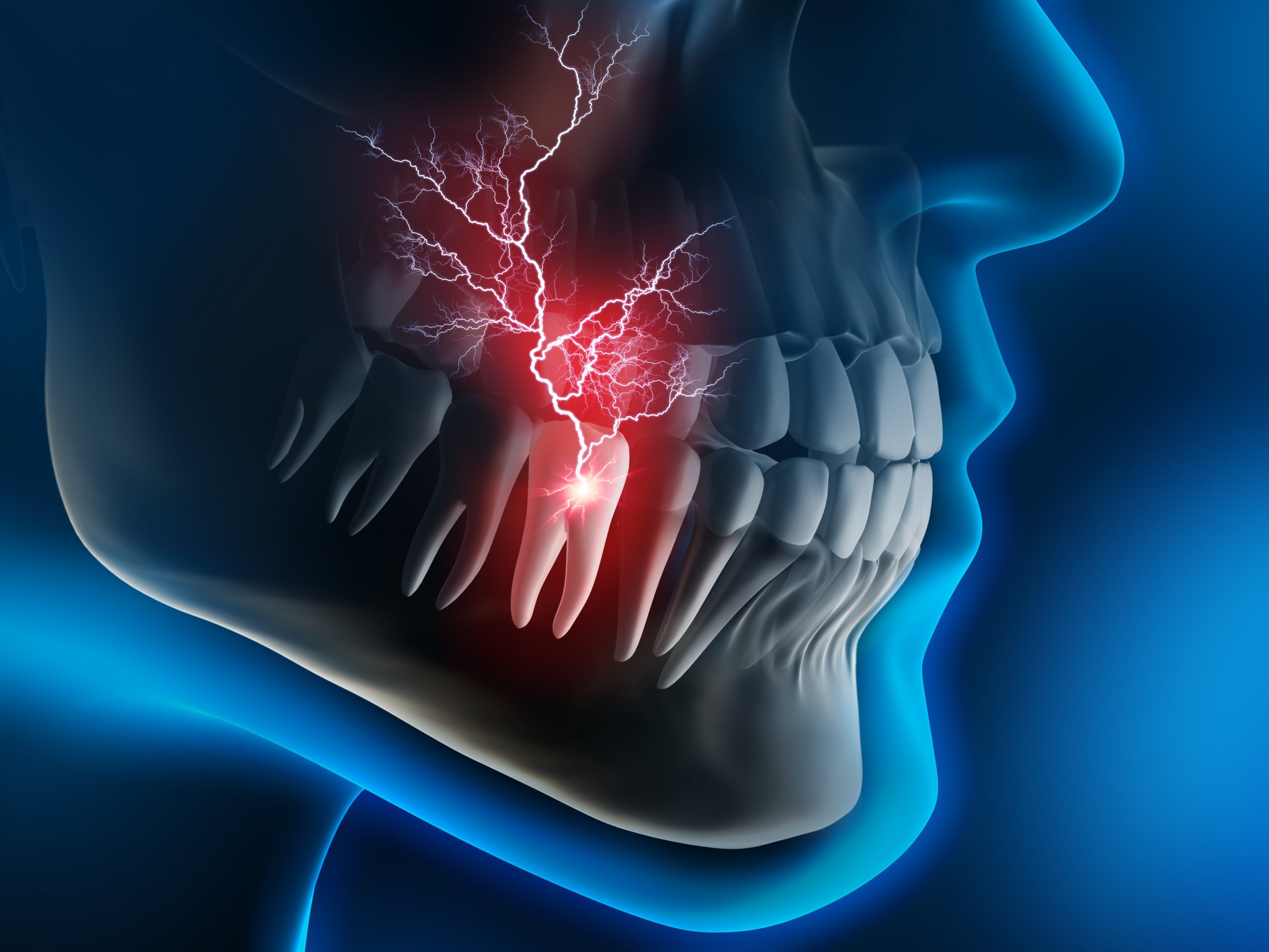 Zahn- und Kieferprobleme können zu sehr weit ausstrahlenden Kieferschmerzen führen